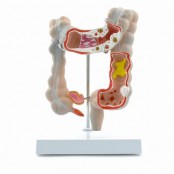 Kidney & Urinary Bladder