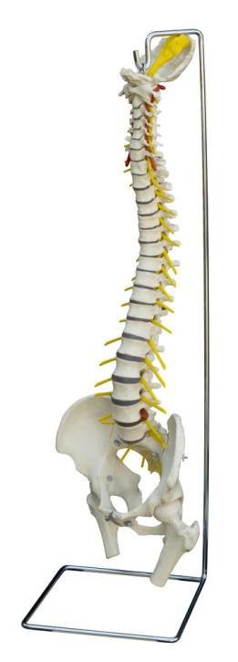 Anatomical Model - Spine with herniated disc