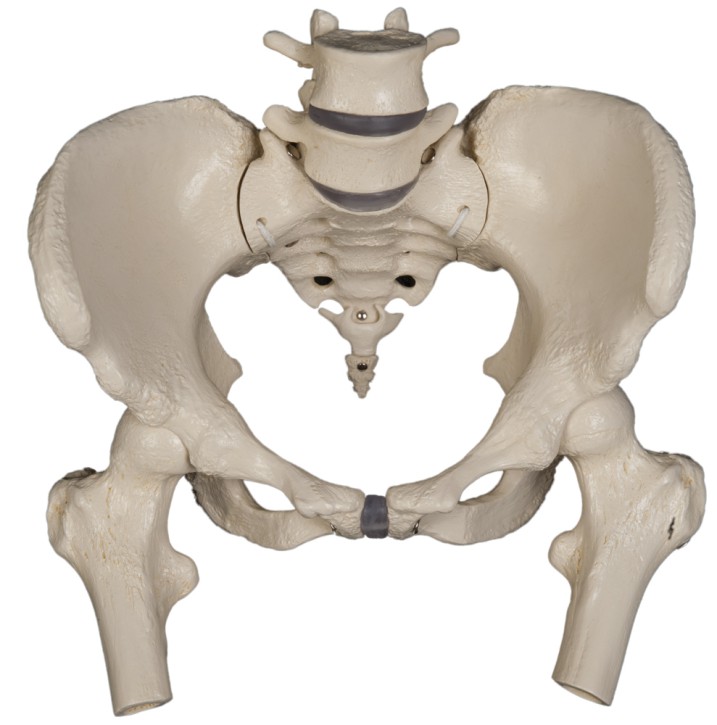 Female pelvis with femur heads