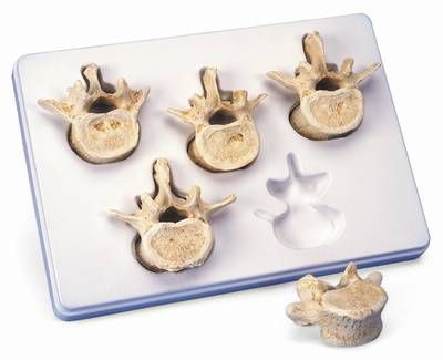 Set of 5 Lumbar Vertebrae