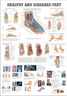 Healthy and Diseased Feet, english, 70 x 100 cm, paper