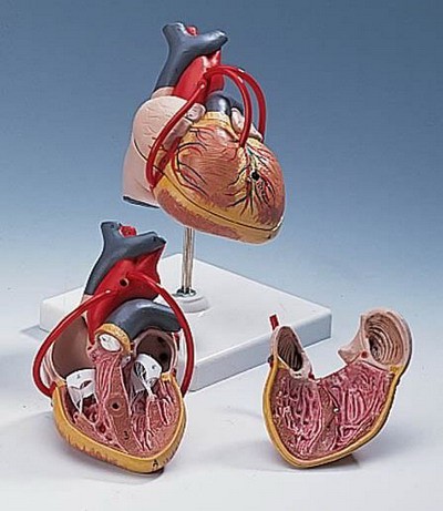 Classic Heart with Bypass, 2-part