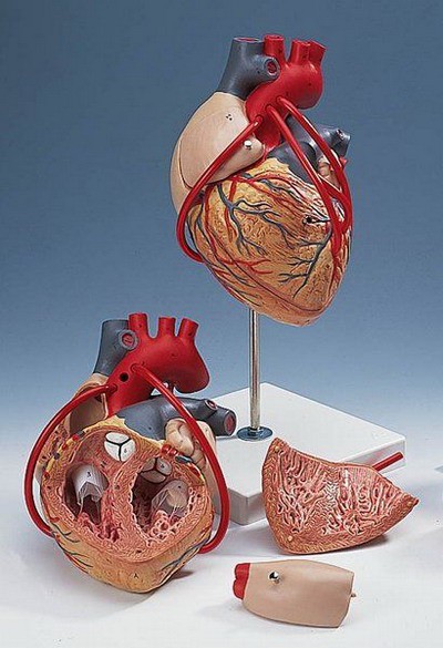 Heart with Bypass, 2 times lifesize, 4-part