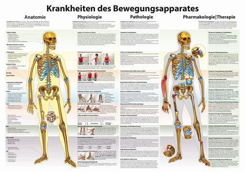 Krankheiten des Bewegungsapparates, 100 x 70 cm, laminiert