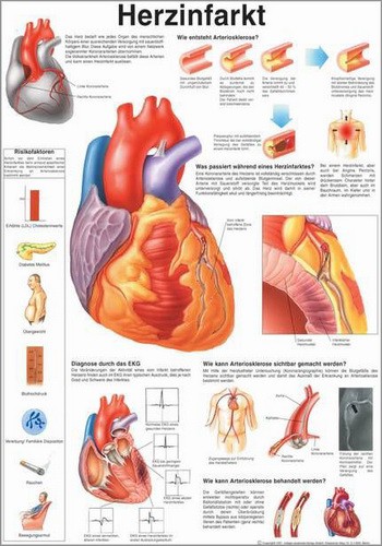 Herzinfarkt, 50 x 70 cm, laminated