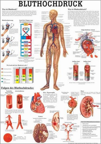 Bluthochdruck, 50 x 70 cm, laminiert