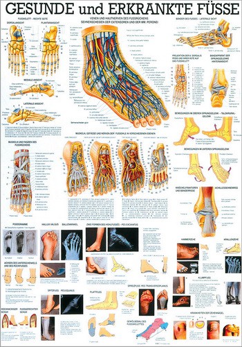 Gesunde und erkrankte Füsse, 70 x 100 cm, laminated