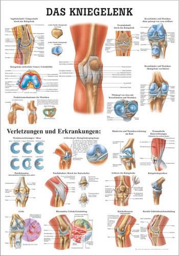 Das Kniegelenk, 70 x 100 cm, laminated