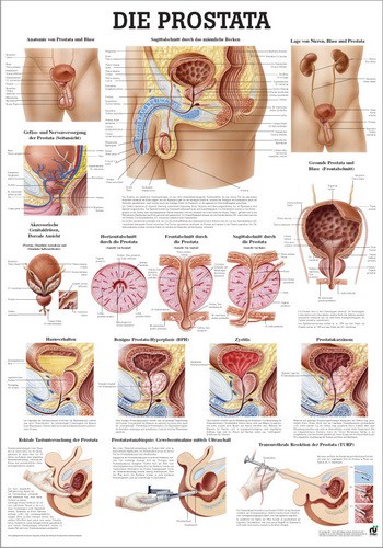 Die Prostata, 70 x 100 cm, laminiert