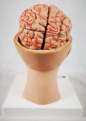 Brain with Arteries on Base of Head, 8-part