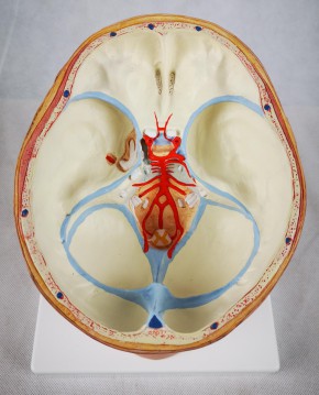 Brain with Arteries on Base of Head, 8-part