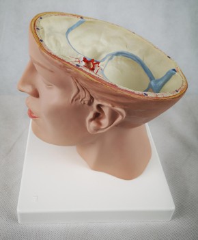 Brain with Arteries on Base of Head, 8-part